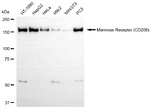CD206 Antibody in Western Blot (WB)