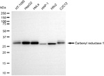 CBR1 Antibody in Western Blot (WB)