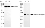 CBR1 Antibody in Western Blot (WB)