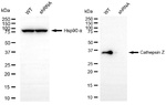 Cathepsin Z Antibody in Western Blot (WB)