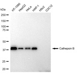 Cathepsin B Recombinant Rabbit Monoclonal Antibody (23GB1130)