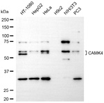 CaMKIV Antibody in Western Blot (WB)