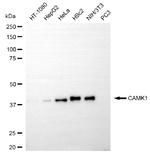 CaMKI Recombinant Rabbit Monoclonal Antibody (25GB570)