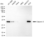 Calponin 2 Antibody in Western Blot (WB)