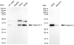 Calponin 1 Antibody in Western Blot (WB)