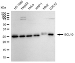 Bcl-10 Antibody in Western Blot (WB)