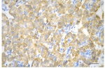 BCAT1 Antibody in Immunohistochemistry (Paraffin) (IHC (P))