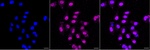 ATM Recombinant Rabbit Monoclonal Antibody (25GB2830)