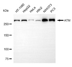 ATM Antibody in Western Blot (WB)