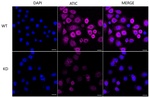 ATIC Antibody in Immunocytochemistry (ICC/IF)