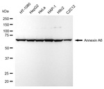 Annexin A6 Recombinant Rabbit Monoclonal Antibody (24GB6820)