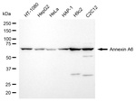 Annexin A6 Antibody in Western Blot (WB)