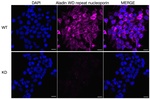 Aladin Antibody in Immunocytochemistry (ICC/IF)
