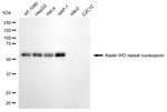 Aladin Antibody in Western Blot (WB)