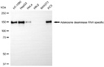ADAR1 Antibody in Western Blot (WB)