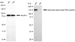 ADAR1 Antibody in Western Blot (WB)