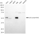 p53 Antibody in Western Blot (WB)