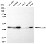 ACADM Antibody in Western Blot (WB)