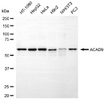 ACAD9 Antibody in Western Blot (WB)