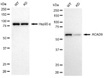 ACAD9 Antibody in Western Blot (WB)