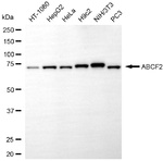 ABCF2 Antibody in Western Blot (WB)