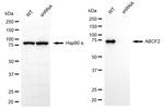 ABCF2 Antibody in Western Blot (WB)