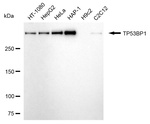 53BP1 Antibody in Western Blot (WB)