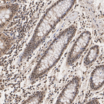 TPI1 Antibody in Immunohistochemistry (Paraffin) (IHC (P))