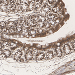 TPI1 Antibody in Immunohistochemistry (Paraffin) (IHC (P))