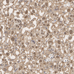 TPI1 Antibody in Immunohistochemistry (Paraffin) (IHC (P))