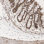 TPI1 Antibody in Immunohistochemistry (Paraffin) (IHC (P))