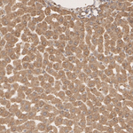 TPI1 Antibody in Immunohistochemistry (Paraffin) (IHC (P))