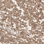 TPI1 Antibody in Immunohistochemistry (Paraffin) (IHC (P))