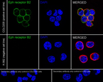 EphB2 Antibody in Immunocytochemistry (ICC/IF)