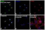EphB2 Recombinant Rabbit Monoclonal Antibody (PSH14-91)