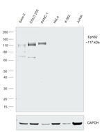 EphB2 Antibody