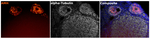 AMH Antibody in Multiplex Immunohistochemistry (mIHC)