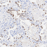 SFTPC Antibody in Immunohistochemistry (Paraffin) (IHC (P))