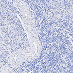 SFTPC Antibody in Immunohistochemistry (Paraffin) (IHC (P))