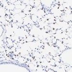 SFTPC Antibody in Immunohistochemistry (Paraffin) (IHC (P))
