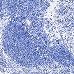 SFTPC Antibody in Immunohistochemistry (Paraffin) (IHC (P))