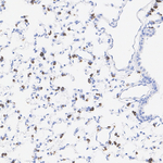 SFTPC Antibody in Immunohistochemistry (Paraffin) (IHC (P))