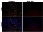 SFTPC Antibody