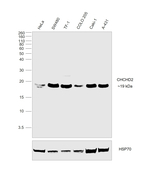CHCHD2 Antibody in Western Blot (WB)