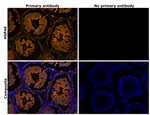 HSP40 Antibody in Immunohistochemistry (Paraffin) (IHC (P))