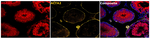 HSP40 Antibody in Multiplex Immunohistochemistry (mIHC)