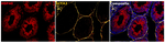HSP40 Antibody in Multiplex Immunohistochemistry (mIHC)