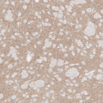 CaV2.3 Antibody in Immunohistochemistry (Paraffin) (IHC (P))