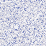 CaV2.3 Recombinant Rabbit Monoclonal Antibody (PSH13-51)