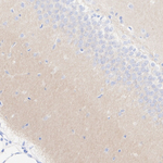 CaV2.3 Antibody in Immunohistochemistry (Paraffin) (IHC (P))